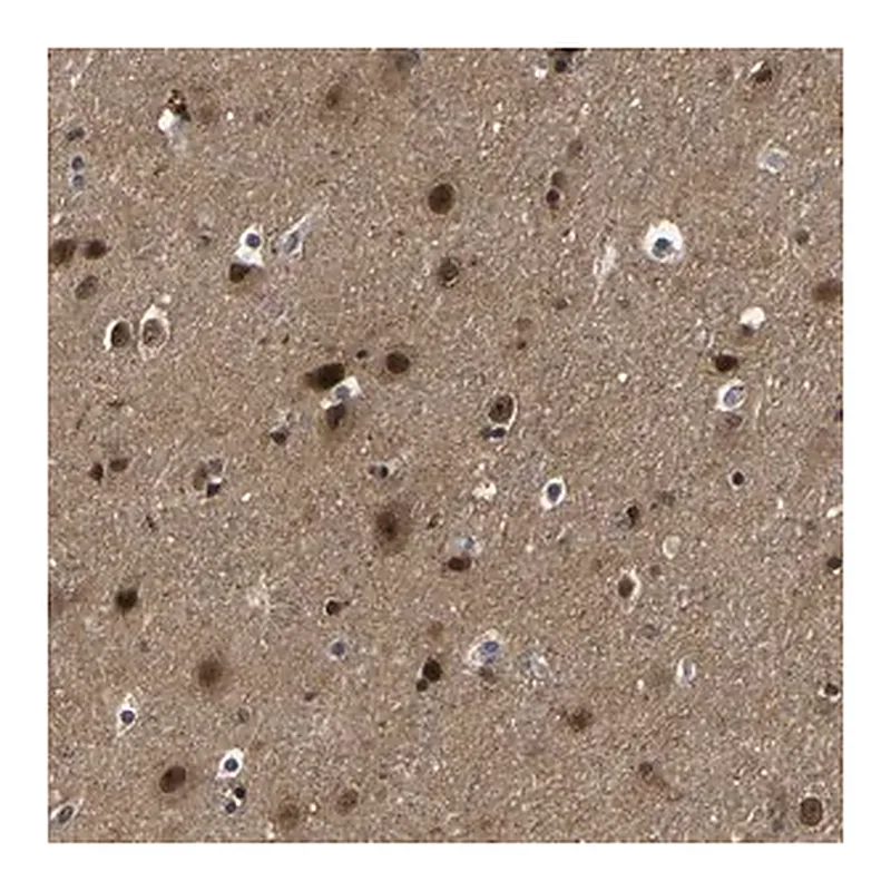Merck Anti-PPM1E antibody produced in rabbit