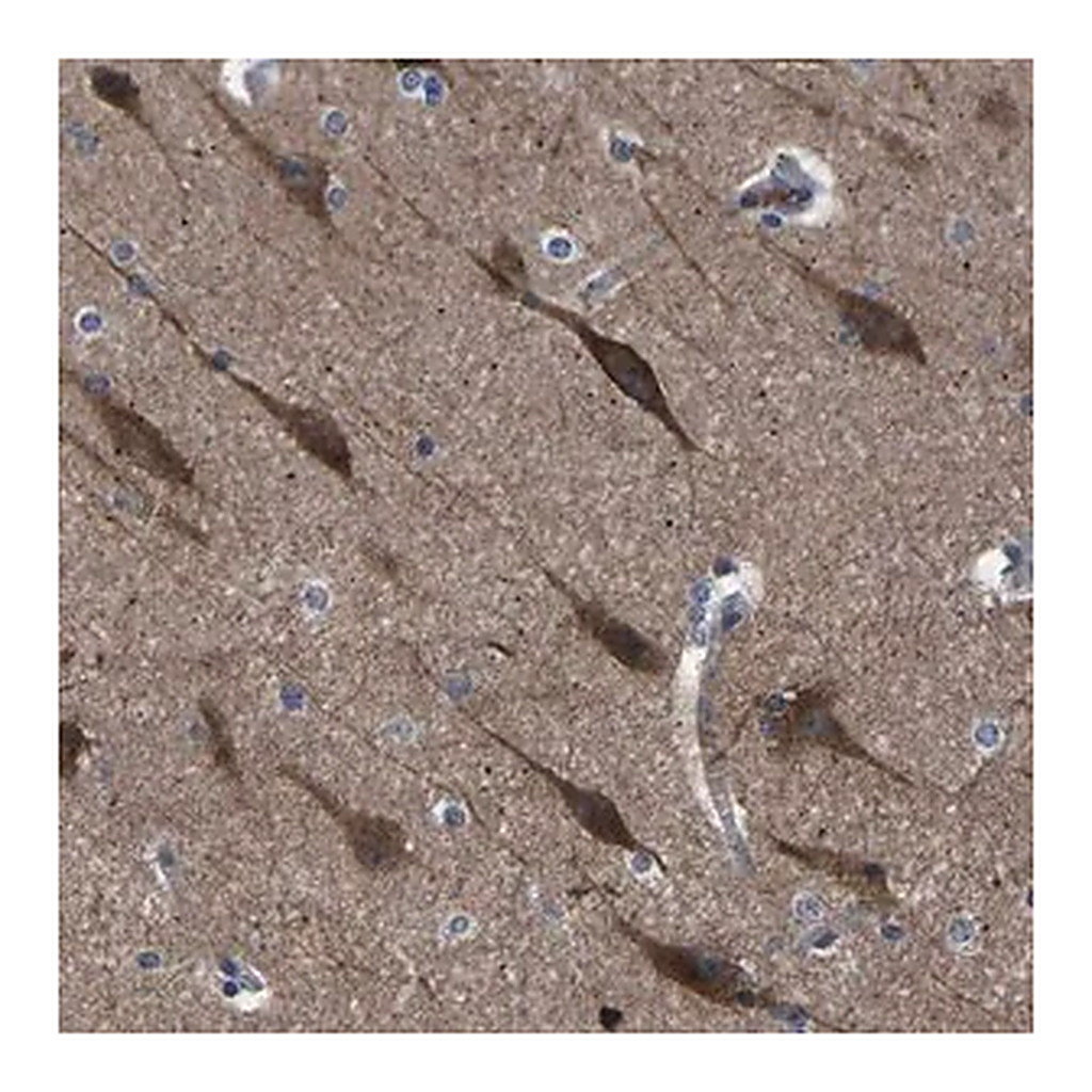 Merck Anti-PAK5 antibody produced in rabbit
