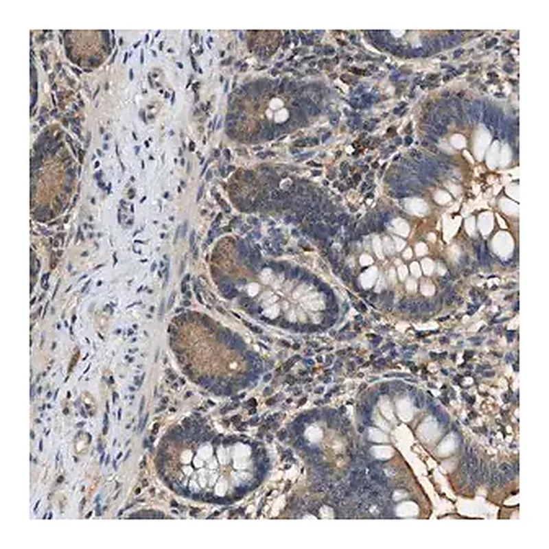 Merck Anti-BCL7C antibody produced in rabbit
