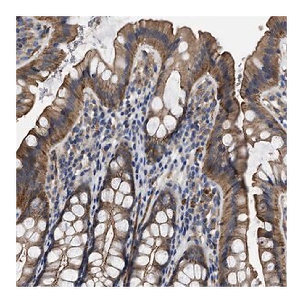 Merck Anti-USP4 antibody produced in rabbit