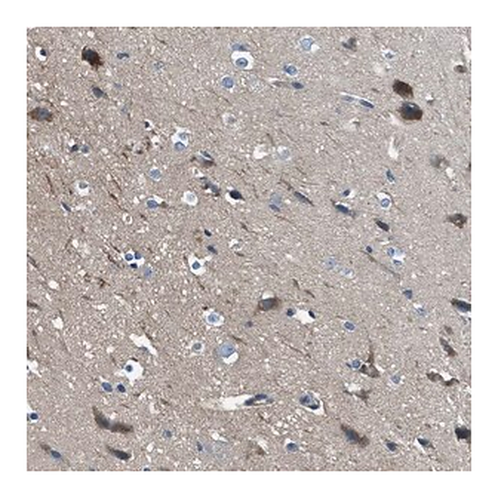Merck Anti-SLC38A6 antibody produced in rabbit