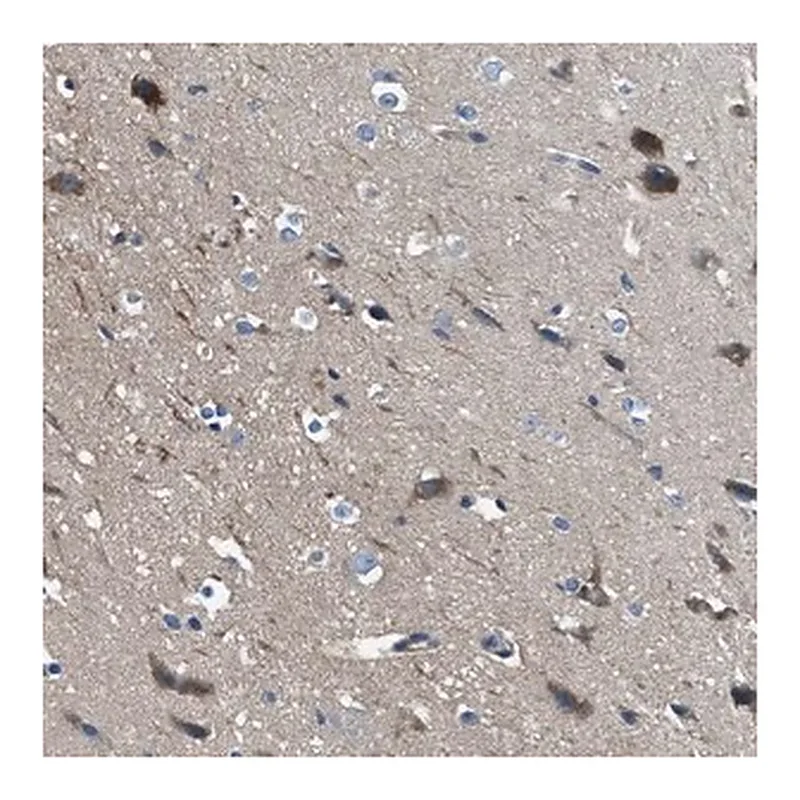 Merck Anti-SLC38A6 antibody produced in rabbit