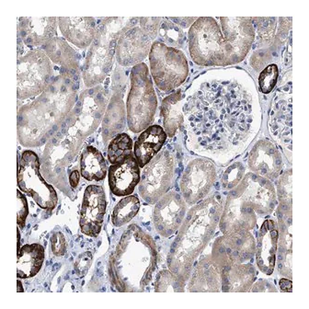 Merck Anti-DHX58 antibody produced in rabbit
