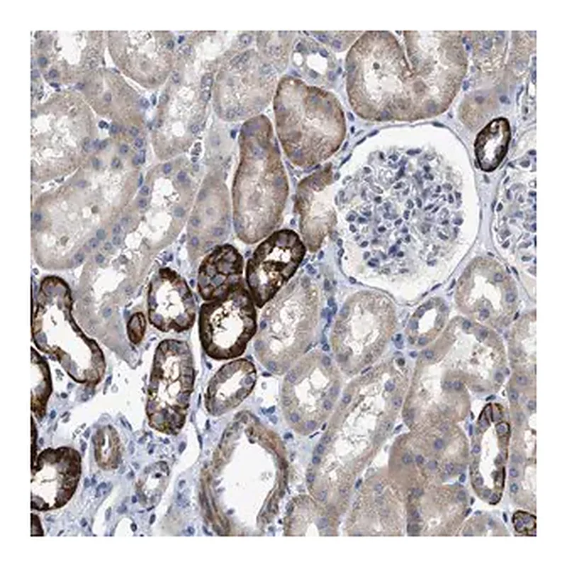 Merck Anti-DHX58 antibody produced in rabbit