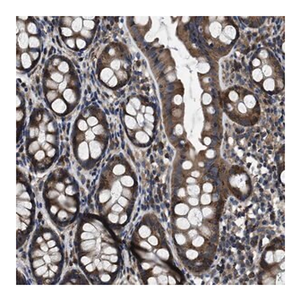 Merck Anti-ANGPT1 antibody produced in rabbit