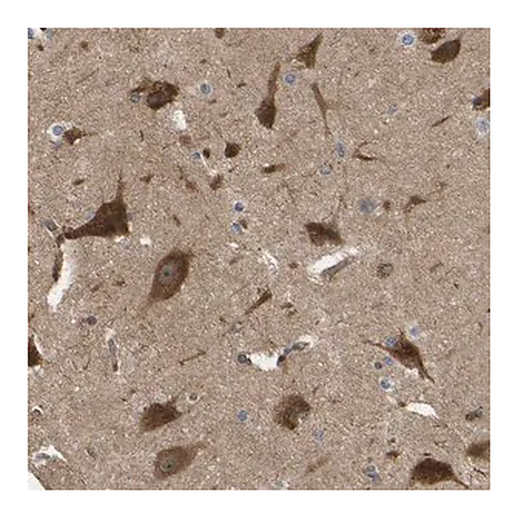 Merck Anti-RASGRF2 antibody produced in rabbit