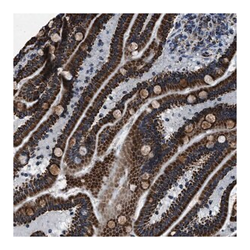 Merck Anti-NSD3 antibody produced in rabbit