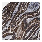 Merck Anti-NSD3 antibody produced in rabbit