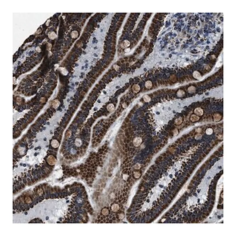 Merck Anti-NSD3 antibody produced in rabbit