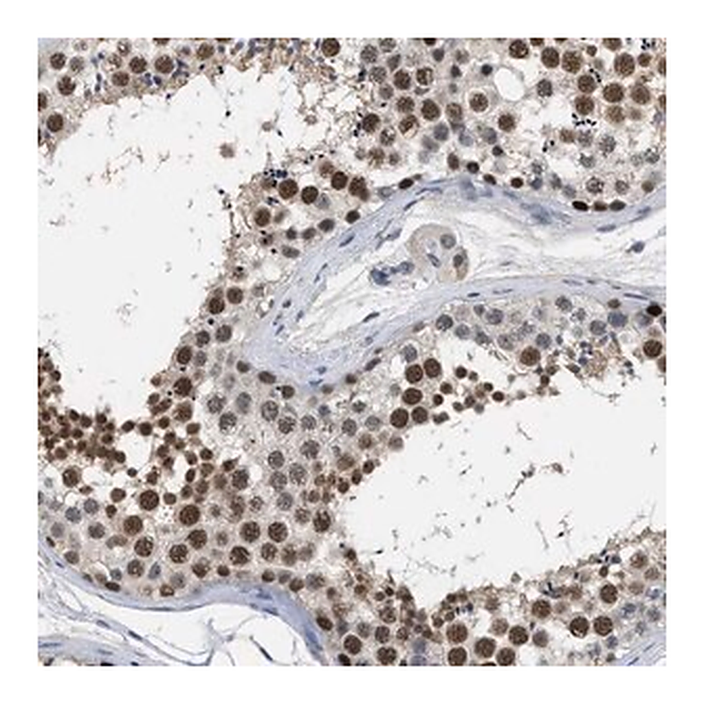 Merck Anti-GGNBP2 antibody produced in rabbit
