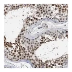 Merck Anti-GGNBP2 antibody produced in rabbit