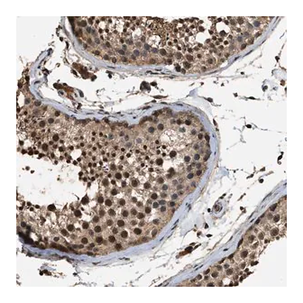 Merck Anti-DENND6B antibody produced in rabbit