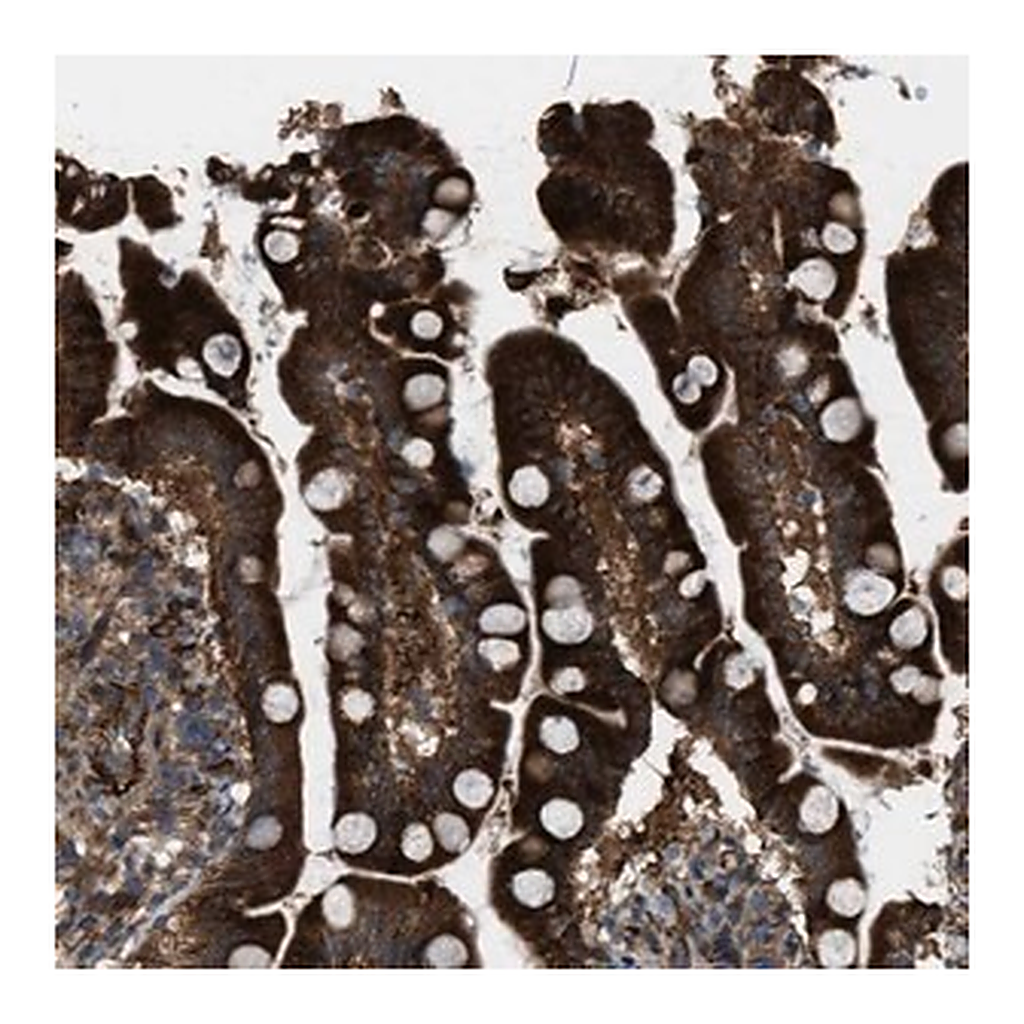 Merck Anti-LRRC72 antibody produced in rabbit