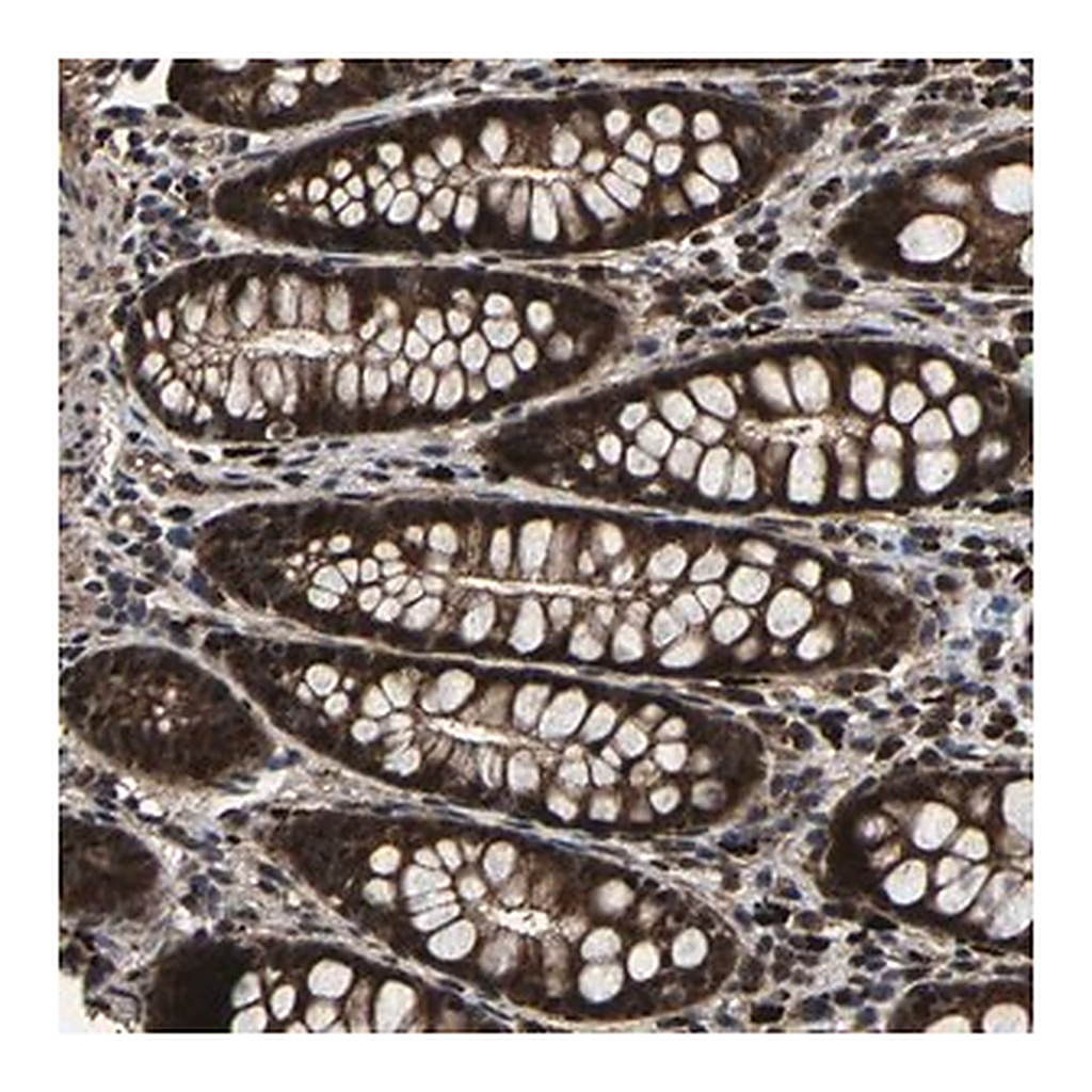 Merck Anti-ZCCHC7 antibody produced in rabbit
