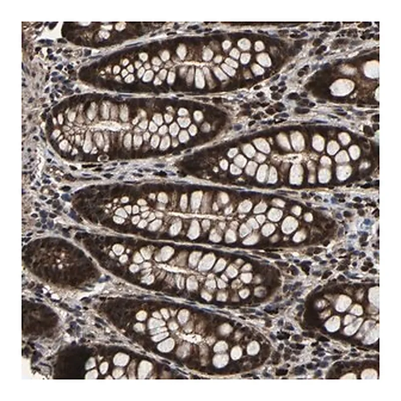 Merck Anti-ZCCHC7 antibody produced in rabbit