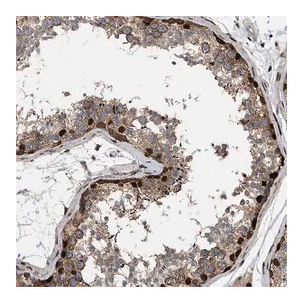 Merck Anti-MDM4 antibody produced in rabbit