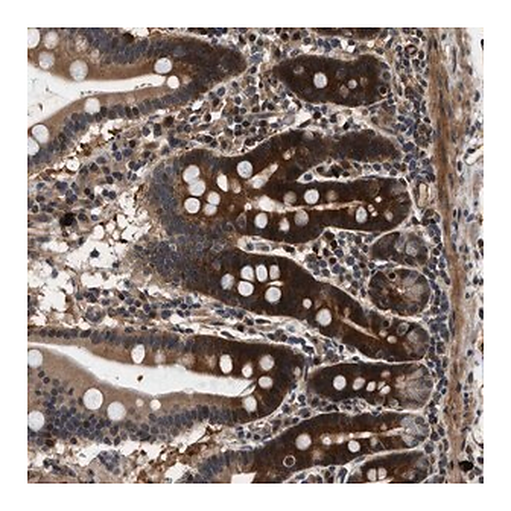 Merck Anti-ZCCHC6 antibody produced in rabbit