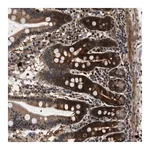 Merck Anti-ZCCHC6 antibody produced in rabbit
