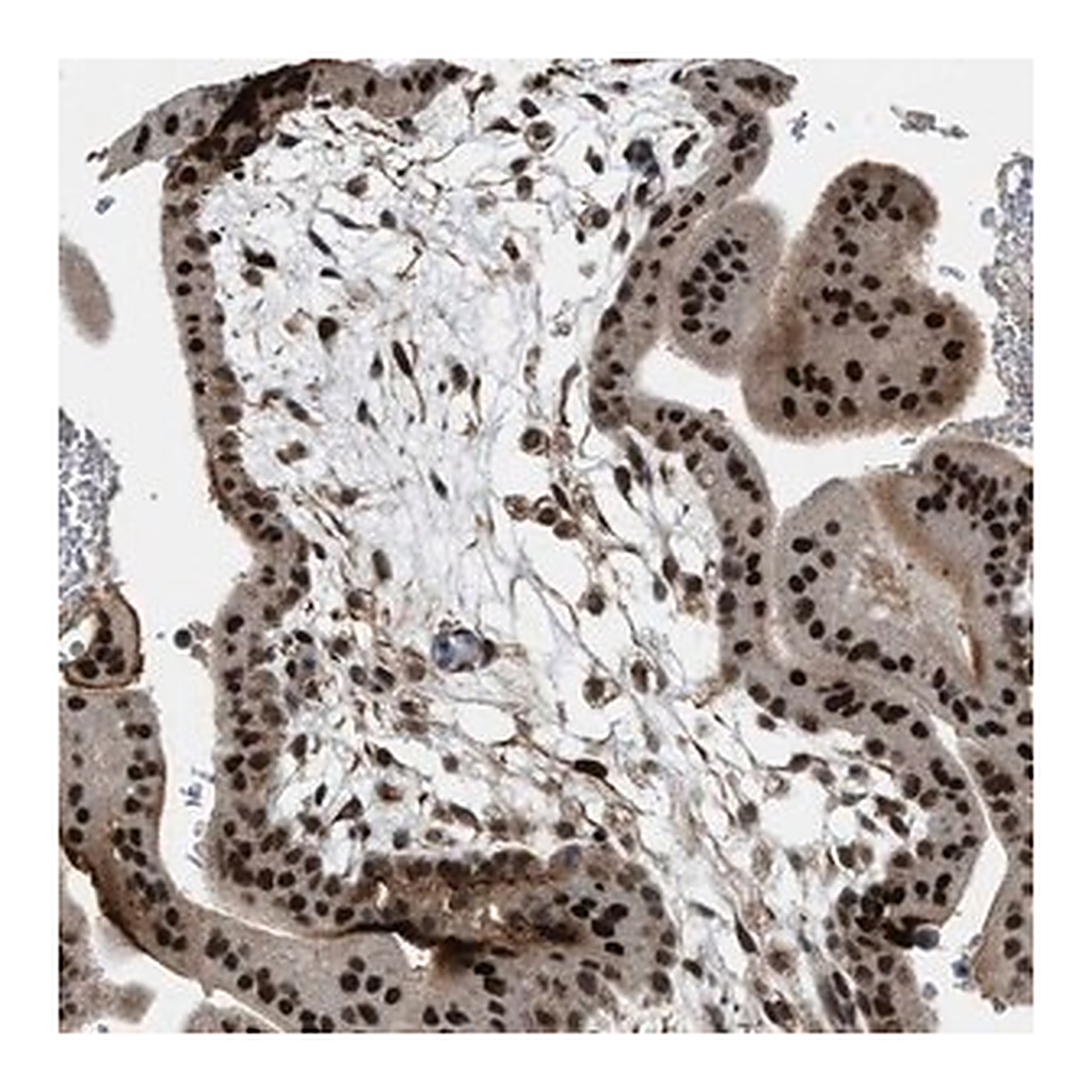 Merck Anti-ZNF250 antibody produced in rabbit