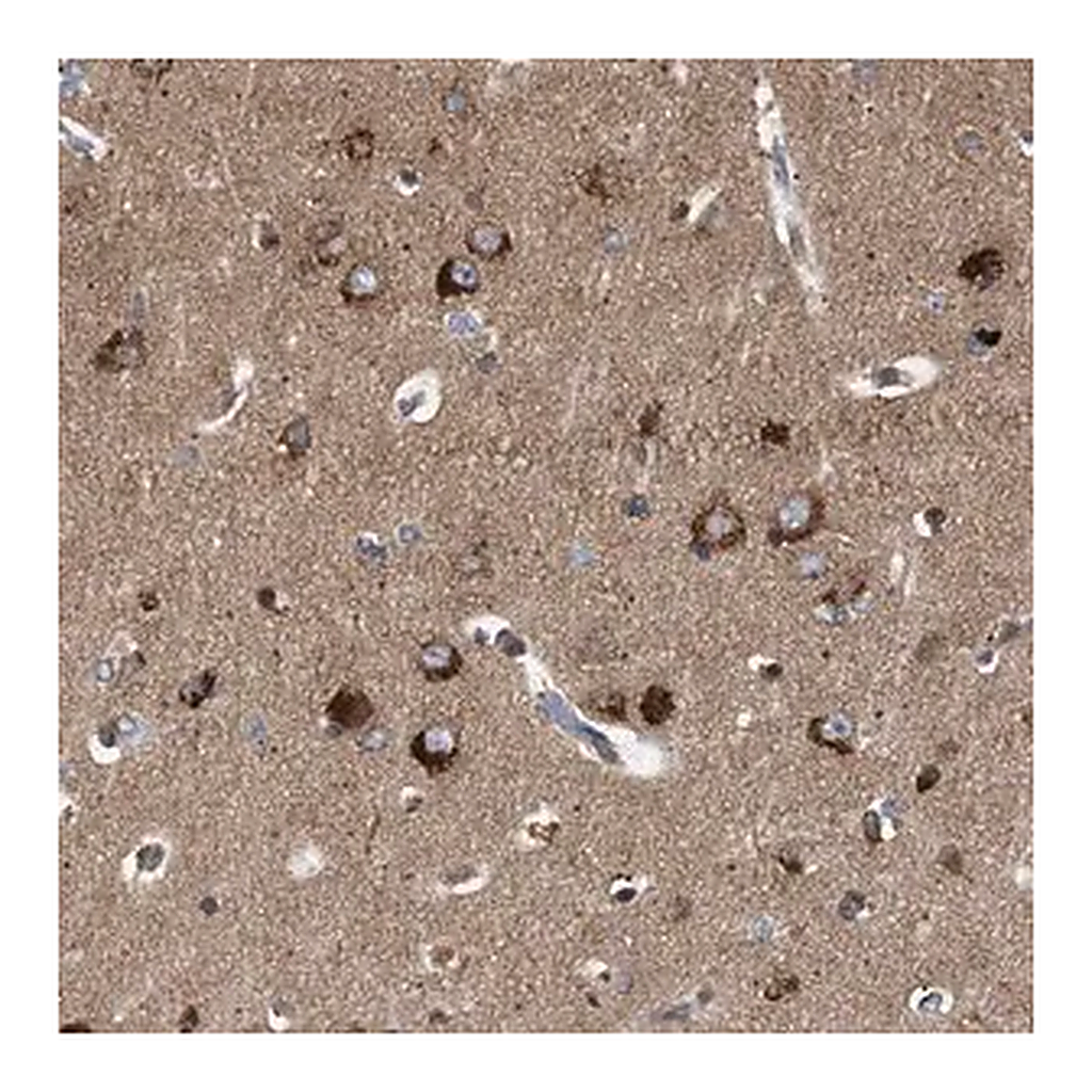 Merck Anti-GUCY1B3 antibody produced in rabbit