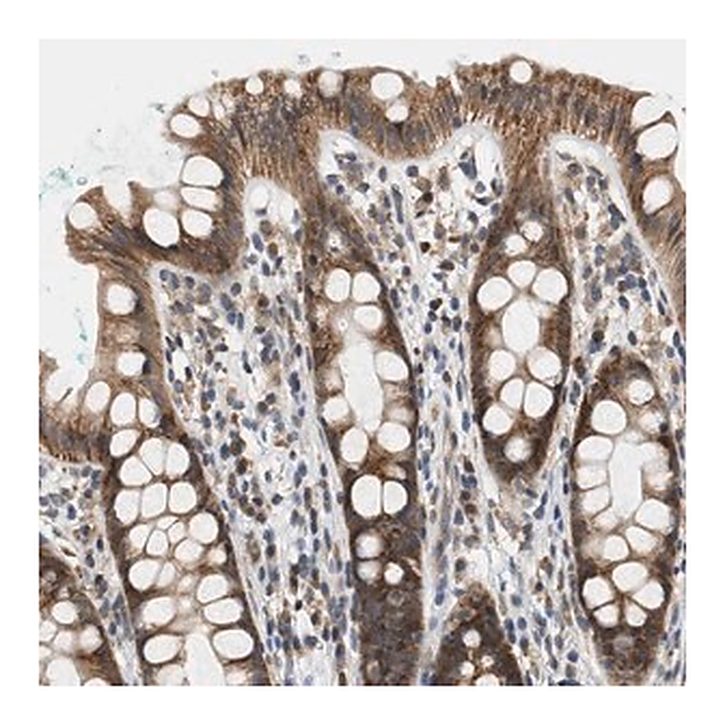 Merck Anti-GIGYF1 antibody produced in rabbit