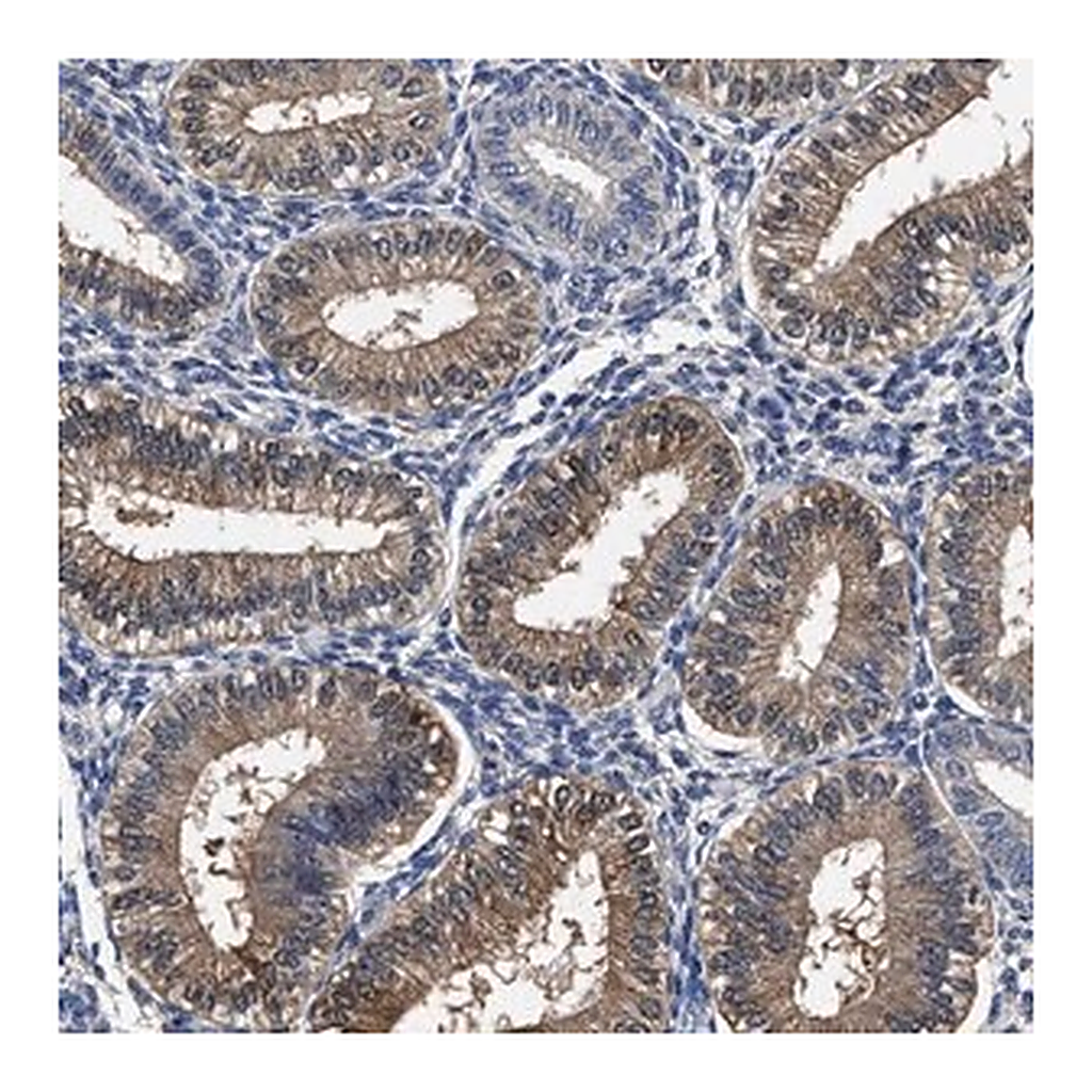 Merck Anti-SOCS5 antibody produced in rabbit
