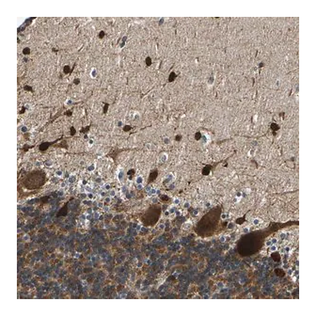 Merck Anti-PPM1E antibody produced in rabbit