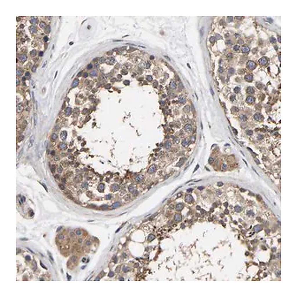 Merck Anti-AIMP2 antibody produced in rabbit