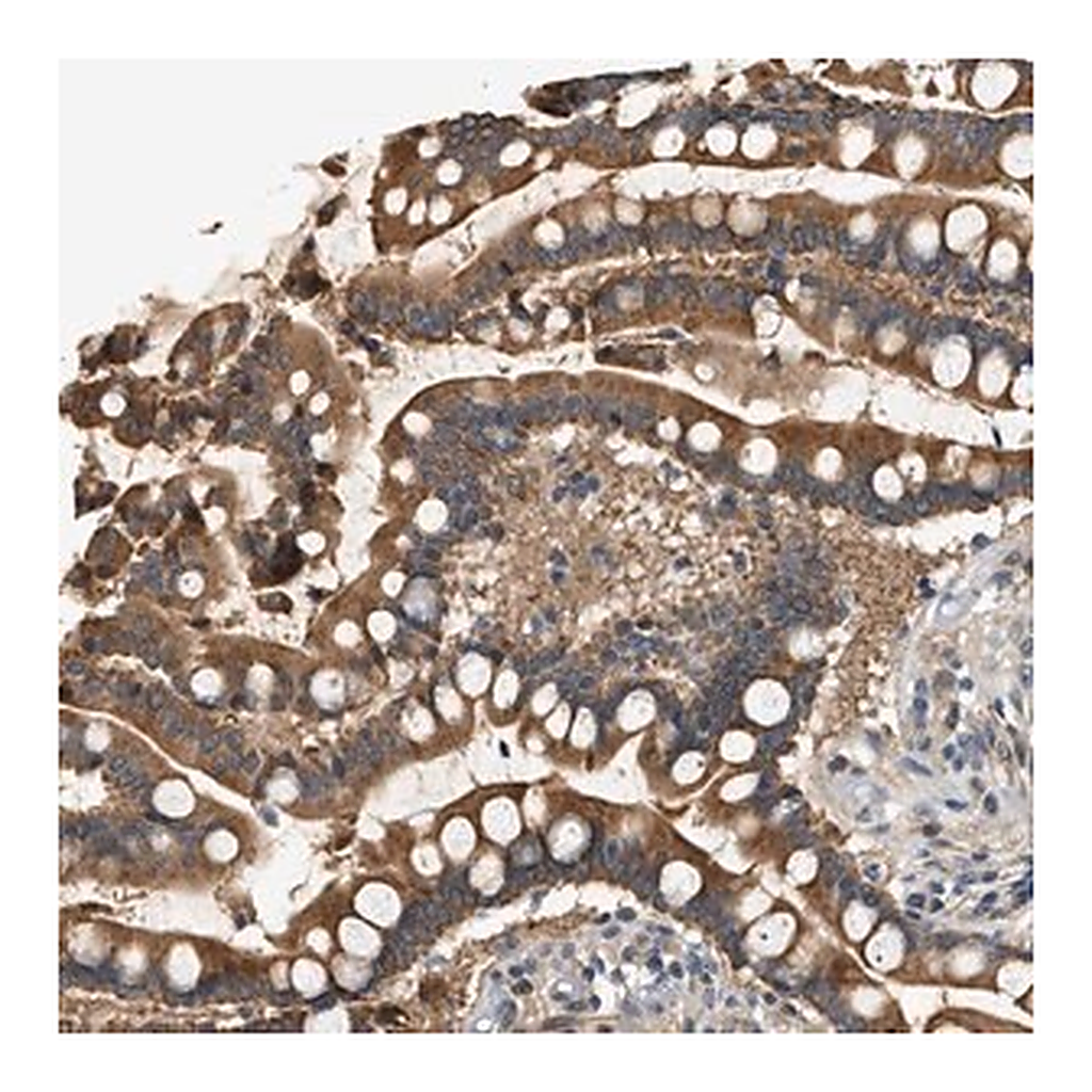 Merck Anti-WDR31 antibody produced in rabbit
