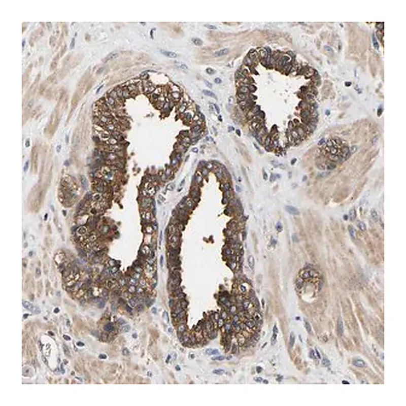 Merck Anti-LRBA antibody produced in rabbit