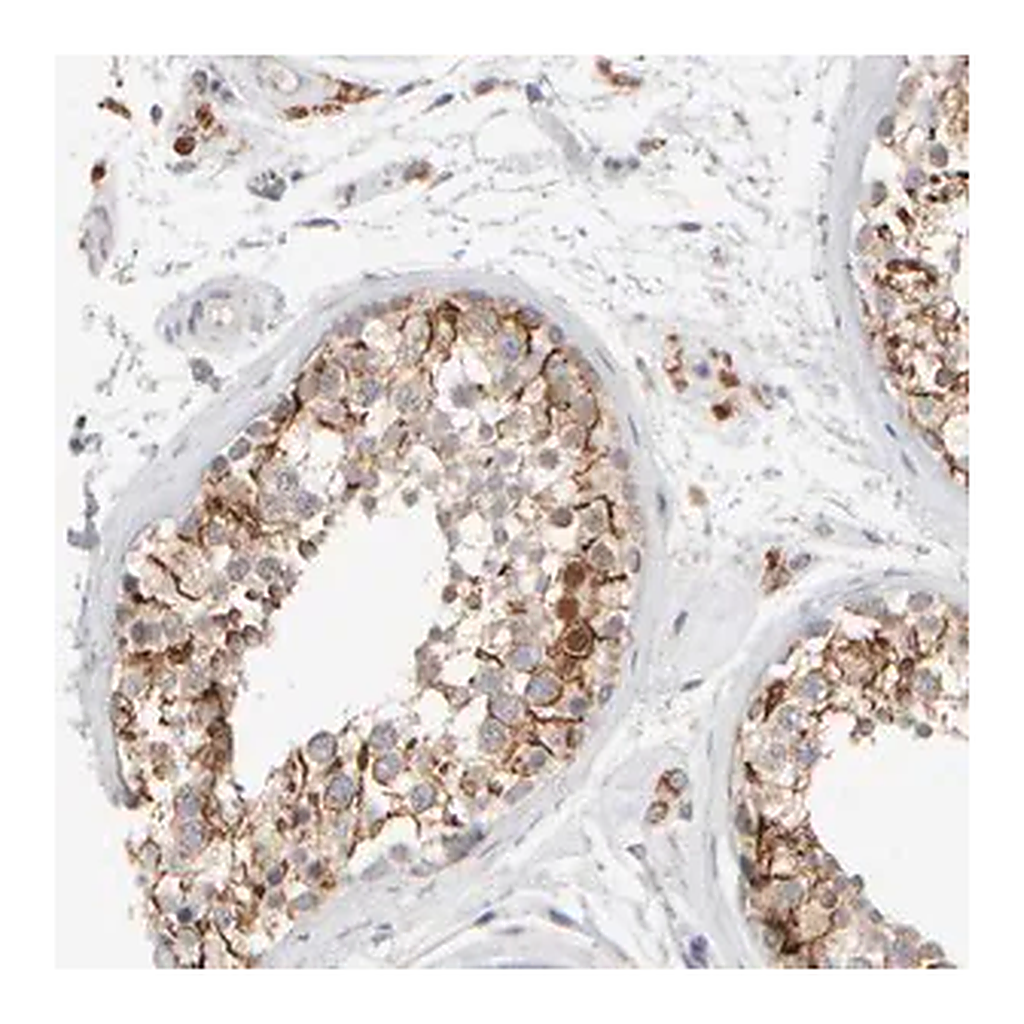 Merck Anti-ZNF112 antibody produced in rabbit