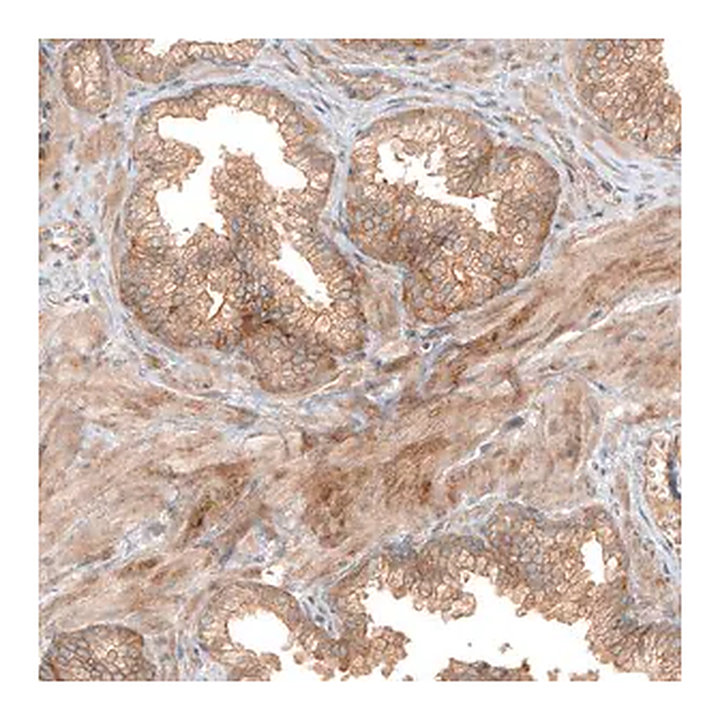 Merck Anti-FAT1 antibody produced in rabbit
