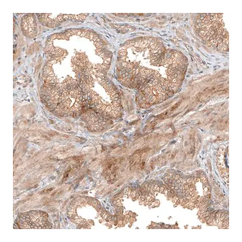 Merck Anti-FAT1 antibody produced in rabbit