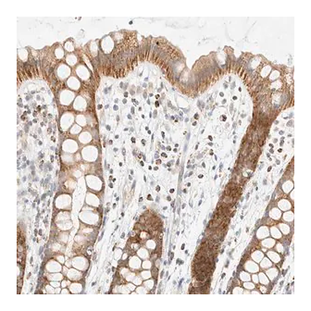 Merck Anti-PPM1K antibody produced in rabbit