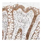 Merck Anti-PPM1K antibody produced in rabbit