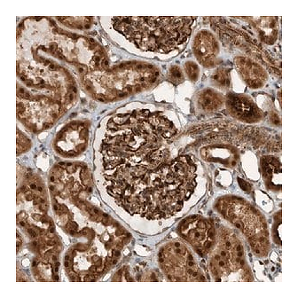 Merck Anti-GIGYF1 antibody produced in rabbit