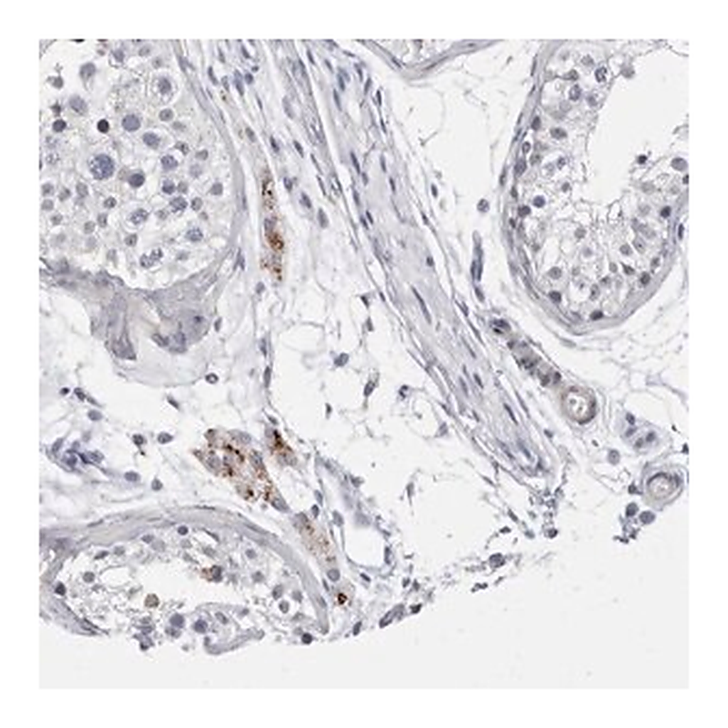 Merck Anti-CATSPERD antibody produced in rabbit