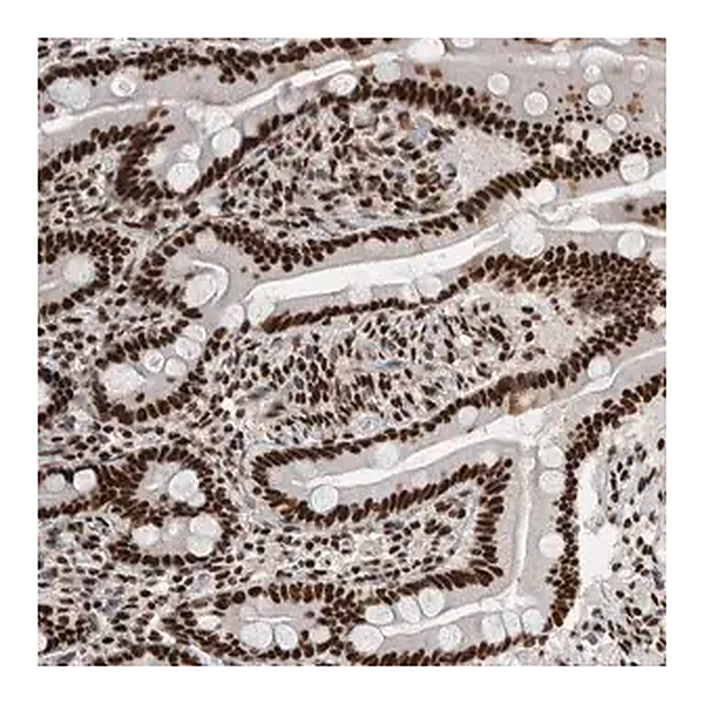 Merck Anti-NCL antibody produced in rabbit