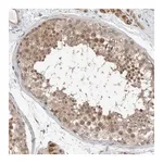 Merck Anti-RERE antibody produced in rabbit