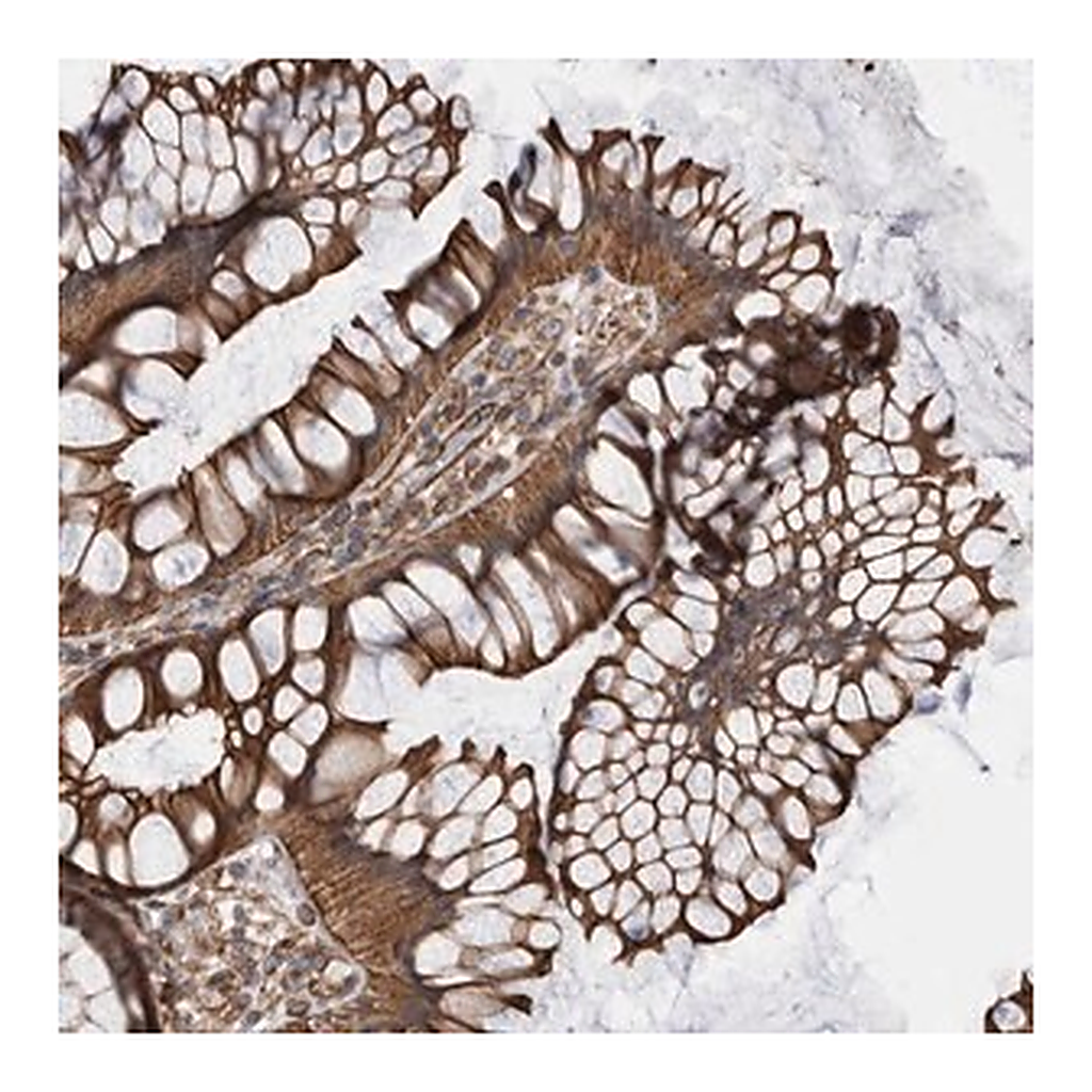 Merck Anti-KIF12 antibody produced in rabbit