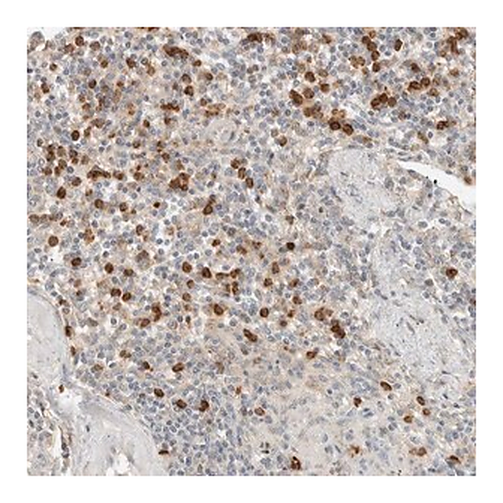 Merck Anti-CCDC171 antibody produced in rabbit