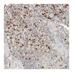 Merck Anti-CCDC171 antibody produced in rabbit