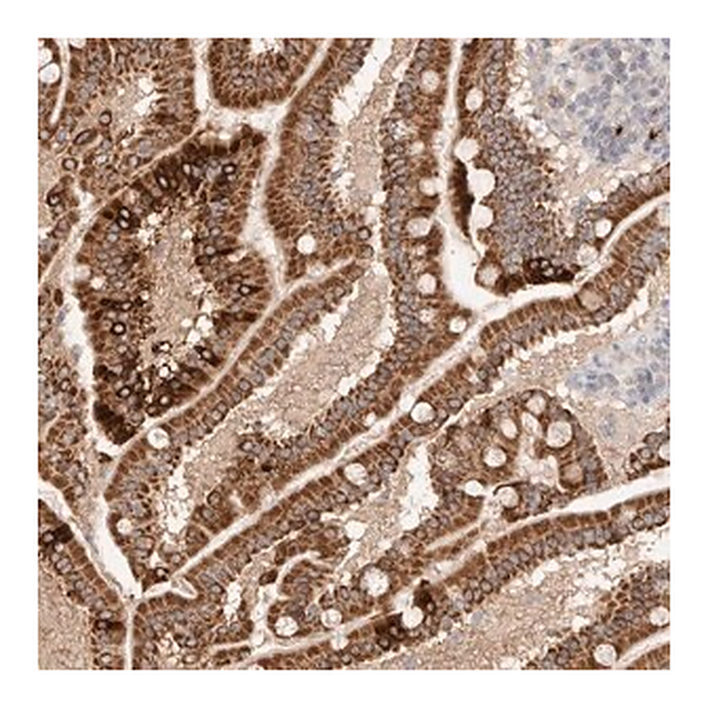 Merck Anti-TRIM41 antibody produced in rabbit