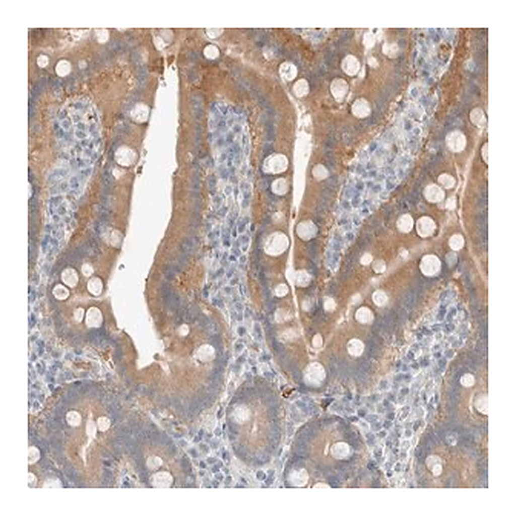 Merck Anti-TRIT1 antibody produced in rabbit