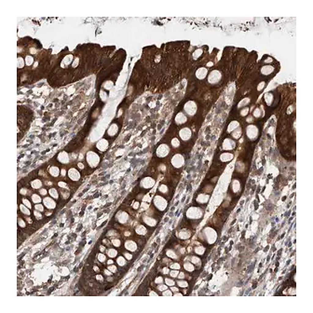 Merck Anti-RIOK3 antibody produced in rabbit