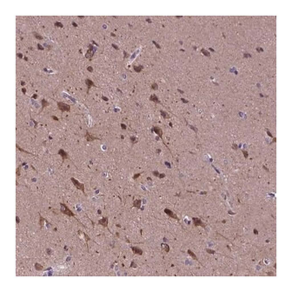 Merck Anti-KIAA1107 antibody produced in rabbit