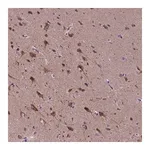 Merck Anti-KIAA1107 antibody produced in rabbit