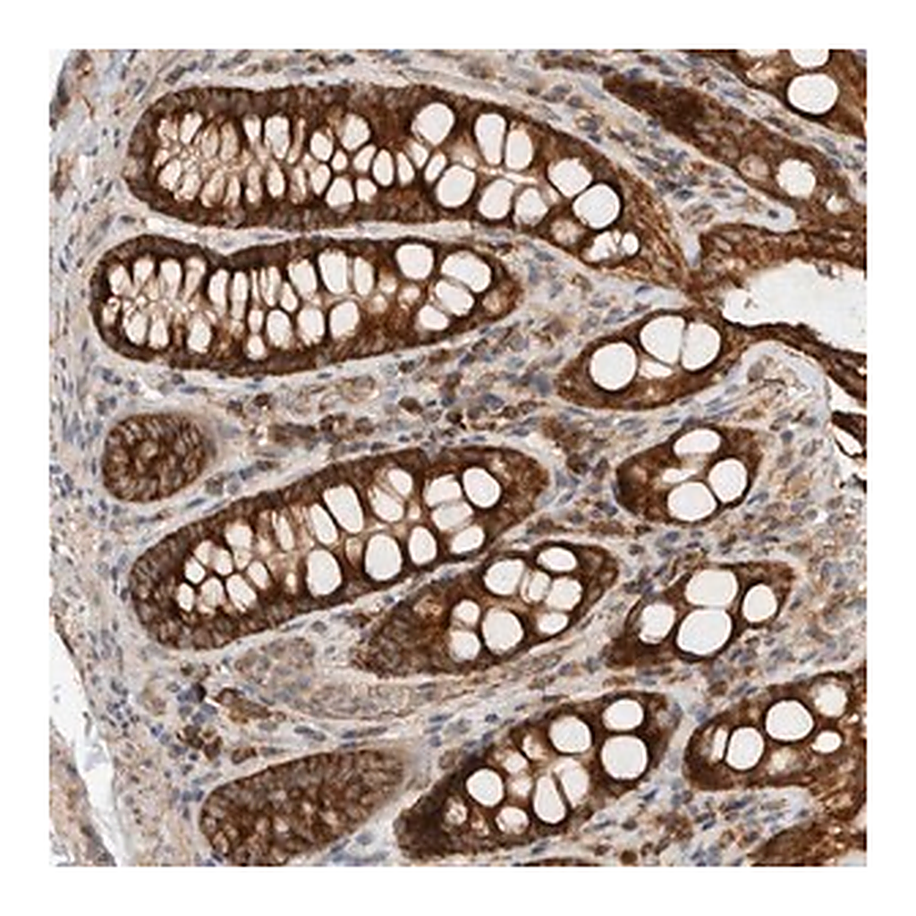 Merck Anti-EIF2B3 antibody produced in rabbit