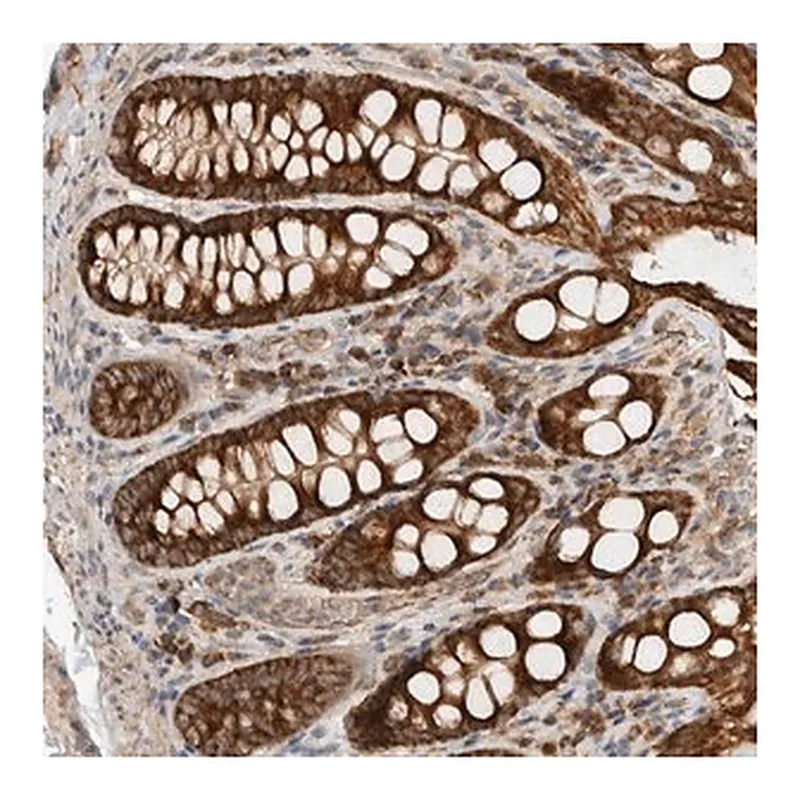 Merck Anti-EIF2B3 antibody produced in rabbit