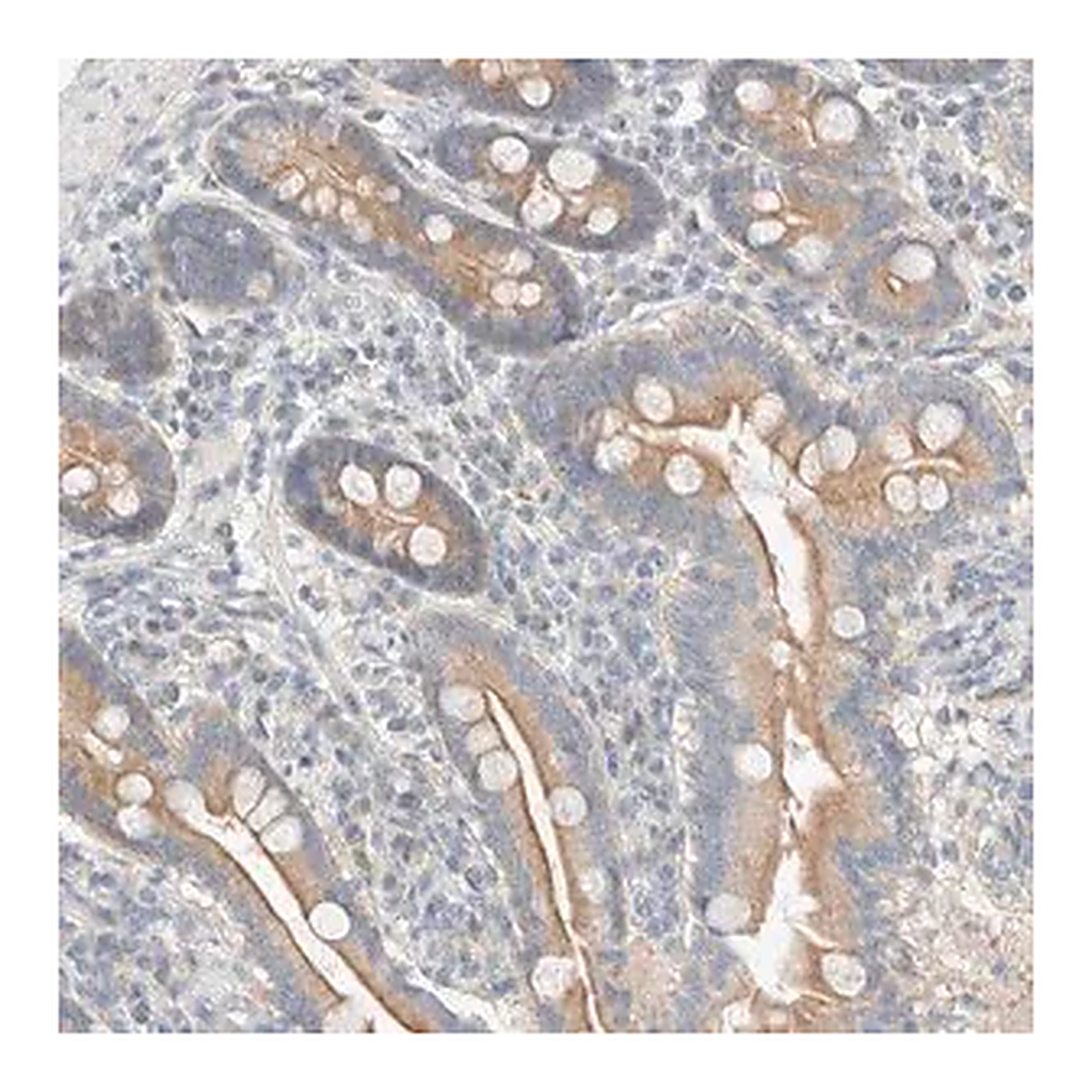 Merck Anti-TUBD1 antibody produced in rabbit